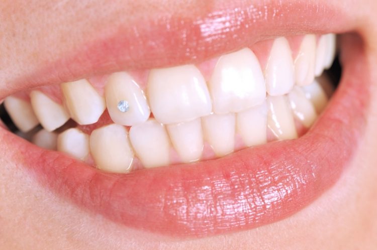 10 bijoux dentaires Swarovski pour un sourire éclatant